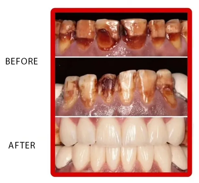 Professional Cleaning